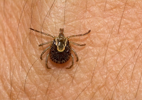 O que é febre maculosa e quais os sintomas